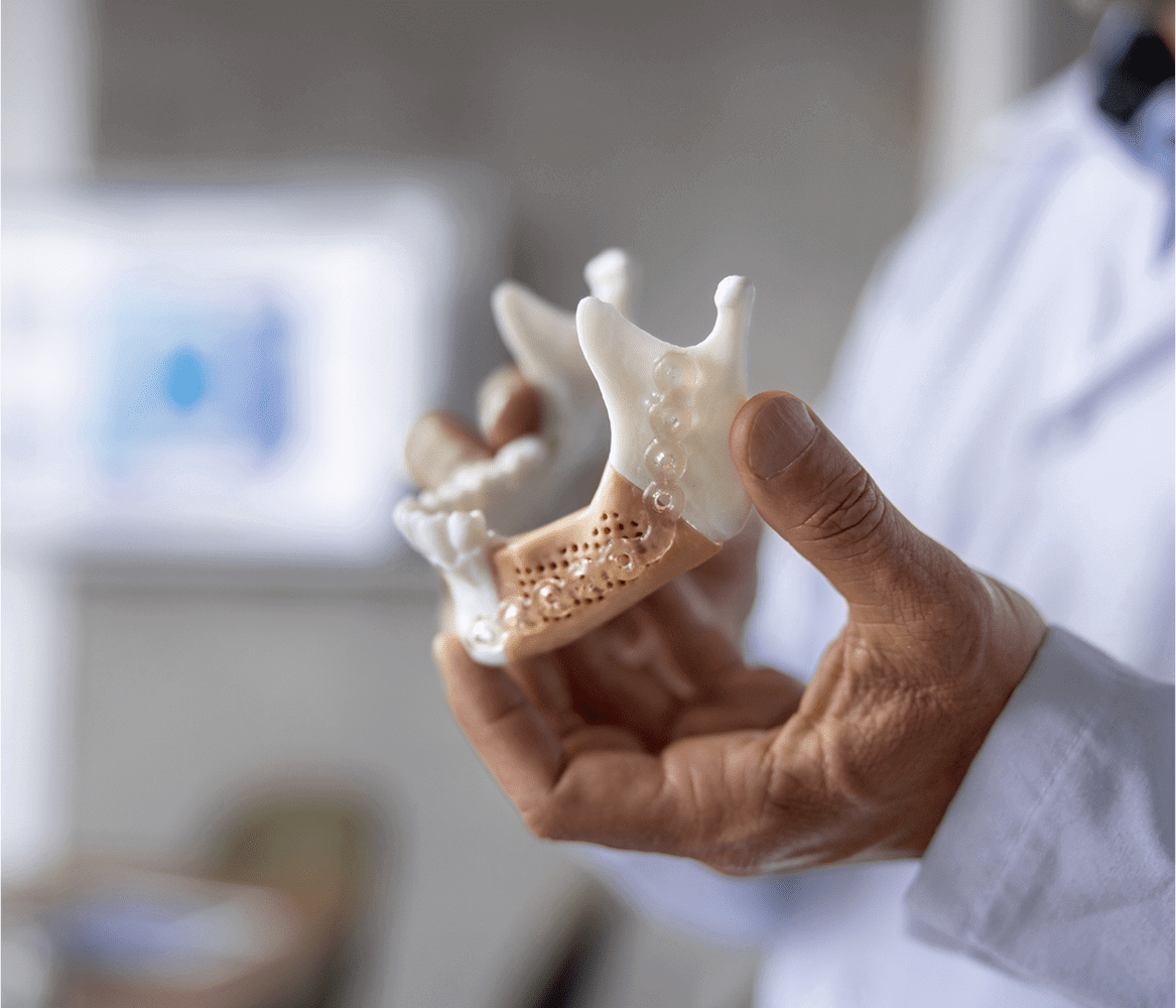 A person holding a 3D-printed dental jaw model.